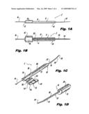 Cannula implantation instrument diagram and image