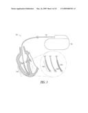 Implantable ultrasound system for maintaining vessel patency and perfusion diagram and image