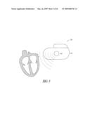 Implantable ultrasound system for maintaining vessel patency and perfusion diagram and image