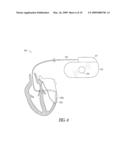 Implantable ultrasound system for maintaining vessel patency and perfusion diagram and image