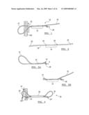 ADJUSTABLE KNOTLESS LOOPS diagram and image