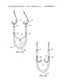 ADJUSTABLE KNOTLESS LOOPS diagram and image