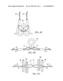 ADJUSTABLE KNOTLESS LOOPS diagram and image