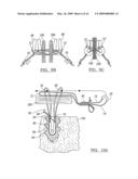 ADJUSTABLE KNOTLESS LOOPS diagram and image