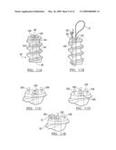 ADJUSTABLE KNOTLESS LOOPS diagram and image