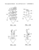 ADJUSTABLE KNOTLESS LOOPS diagram and image