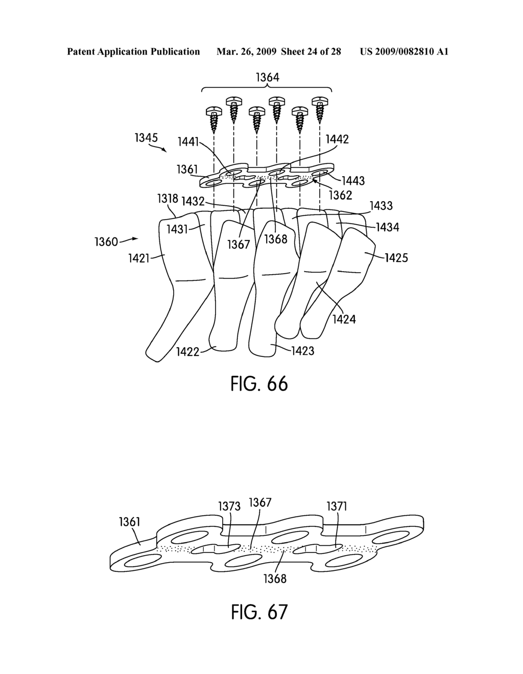 Spinal Fixation with Selectively Applied Bone Growth Promoting Agent - diagram, schematic, and image 25