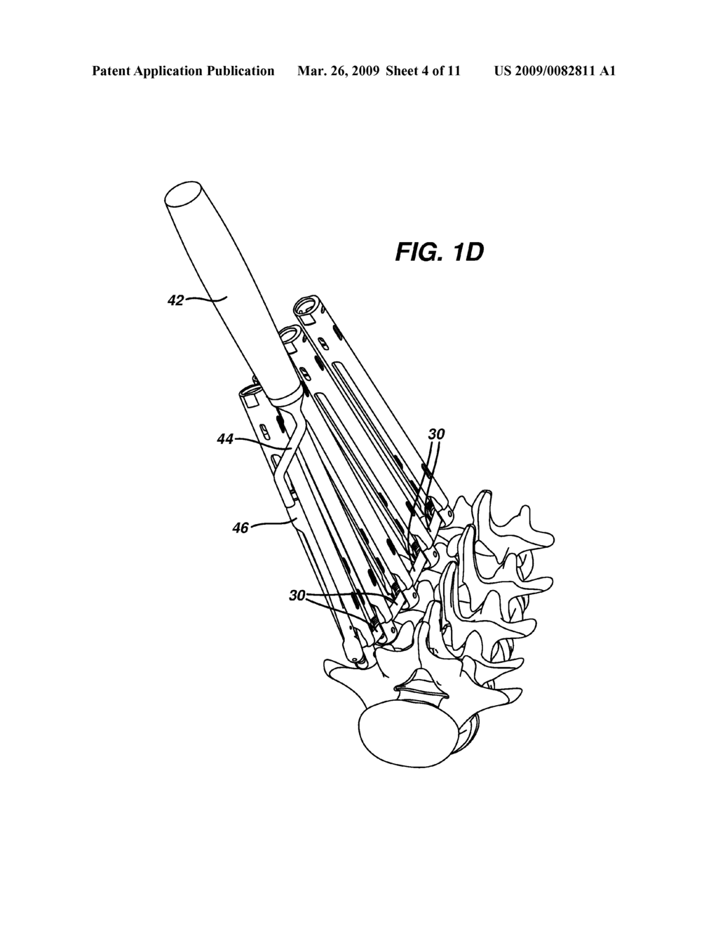 DEVICES AND METHODS FOR POSITIONING A SPINAL FIXATION ELEMENT - diagram, schematic, and image 05