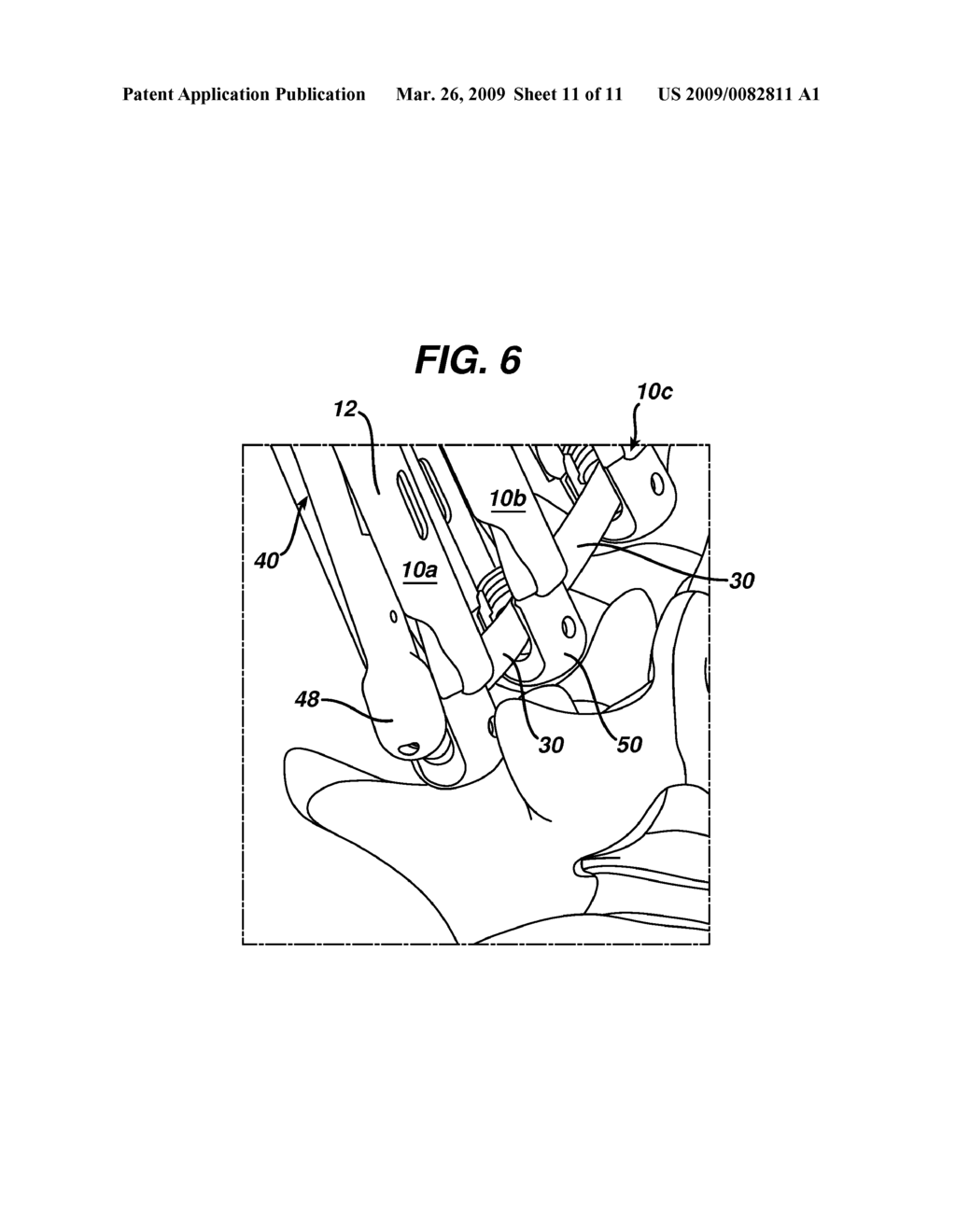 DEVICES AND METHODS FOR POSITIONING A SPINAL FIXATION ELEMENT - diagram, schematic, and image 12