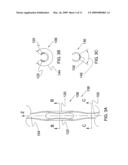 Ocular Implant Architectures diagram and image