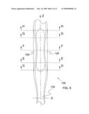 Ocular Implant Architectures diagram and image