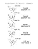 Ocular Implant Architectures diagram and image