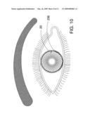 Ocular Implant Architectures diagram and image