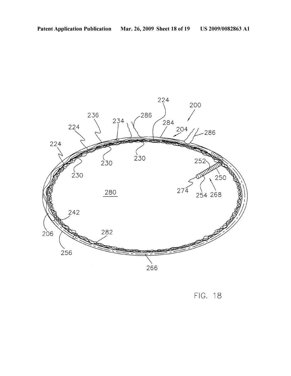 Ocular Implants - diagram, schematic, and image 19