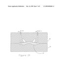 Prosthesis for restoring motion in an appendage or spinal joint and an intervertebral spacer diagram and image