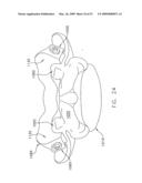 METHOD AND APPARATUS FOR SPINE JOINT REPLACEMENT diagram and image