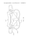 METHOD AND APPARATUS FOR SPINE JOINT REPLACEMENT diagram and image