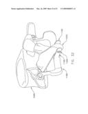 METHOD AND APPARATUS FOR SPINE JOINT REPLACEMENT diagram and image