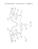 METHOD AND APPARATUS FOR SPINE JOINT REPLACEMENT diagram and image