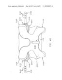 METHOD AND APPARATUS FOR SPINE JOINT REPLACEMENT diagram and image