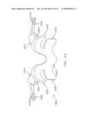 METHOD AND APPARATUS FOR SPINE JOINT REPLACEMENT diagram and image