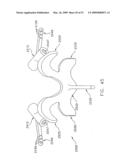 METHOD AND APPARATUS FOR SPINE JOINT REPLACEMENT diagram and image