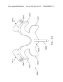 METHOD AND APPARATUS FOR SPINE JOINT REPLACEMENT diagram and image