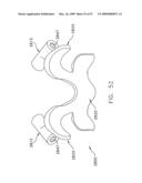 METHOD AND APPARATUS FOR SPINE JOINT REPLACEMENT diagram and image