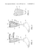 VENTILATED PROSTHESIS SYSTEM diagram and image