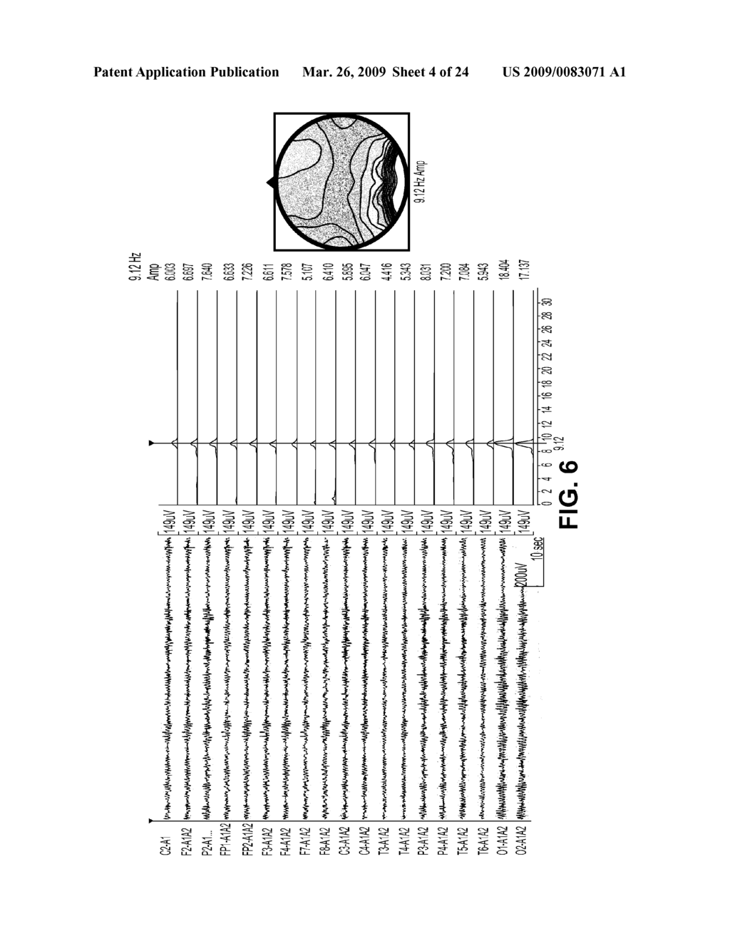 Systems and Methods for Controlling and Billing Neuro-EEG Synchronization Therapy - diagram, schematic, and image 05