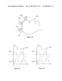 Systems and Methods for Controlling and Billing Neuro-EEG Synchronization Therapy diagram and image