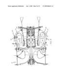 ON-WING COMBUSTOR CLEANING USING DIRECT INSERTION NOZZLE, WASH AGENT, AND PROCEDURE diagram and image