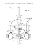 System and Method for Assembling a Tire and a Wheel diagram and image