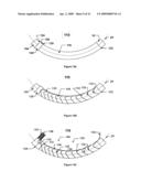Conductor Assembly Having An Axial Field In Combination With High Quality Main Transverse Field diagram and image