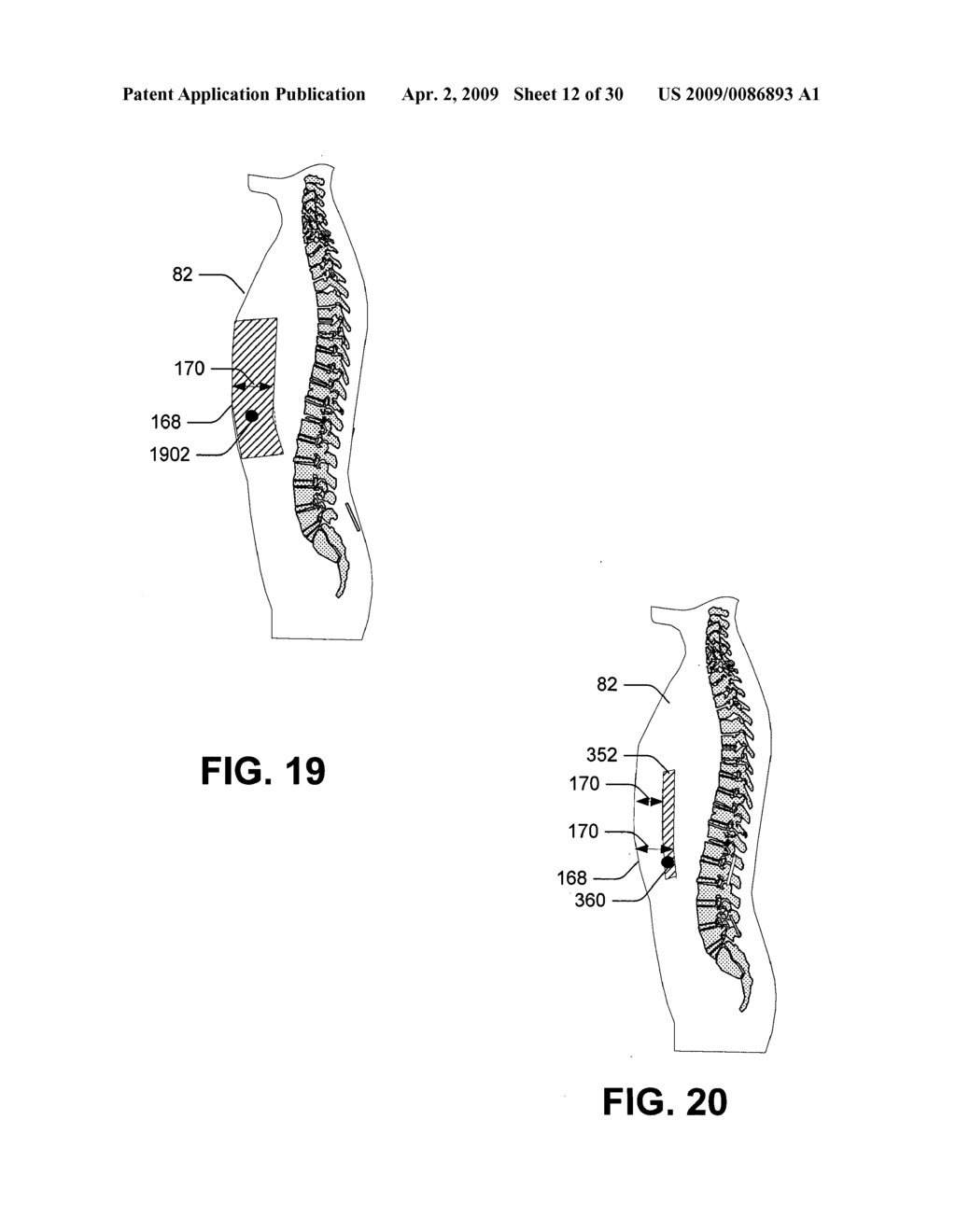 Combining X-Ray fluorescence visualizer, imager, or information provider - diagram, schematic, and image 13