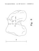 Apparatus and Method for Fabricating a Customized Patient-Specific Orthopaedic Instrument diagram and image