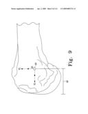 Apparatus and Method for Fabricating a Customized Patient-Specific Orthopaedic Instrument diagram and image