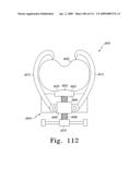 Apparatus and Method for Fabricating a Customized Patient-Specific Orthopaedic Instrument diagram and image