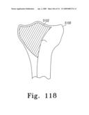 Apparatus and Method for Fabricating a Customized Patient-Specific Orthopaedic Instrument diagram and image