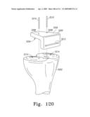 Apparatus and Method for Fabricating a Customized Patient-Specific Orthopaedic Instrument diagram and image