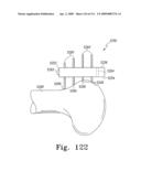 Apparatus and Method for Fabricating a Customized Patient-Specific Orthopaedic Instrument diagram and image