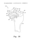 Apparatus and Method for Fabricating a Customized Patient-Specific Orthopaedic Instrument diagram and image