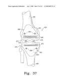 Apparatus and Method for Fabricating a Customized Patient-Specific Orthopaedic Instrument diagram and image