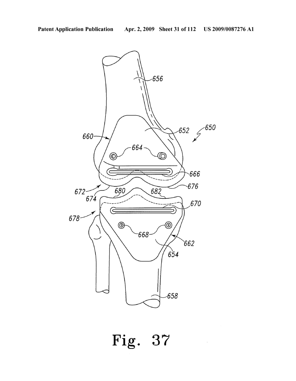 Apparatus and Method for Fabricating a Customized Patient-Specific Orthopaedic Instrument - diagram, schematic, and image 32