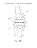 Apparatus and Method for Fabricating a Customized Patient-Specific Orthopaedic Instrument diagram and image