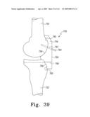 Apparatus and Method for Fabricating a Customized Patient-Specific Orthopaedic Instrument diagram and image