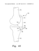 Apparatus and Method for Fabricating a Customized Patient-Specific Orthopaedic Instrument diagram and image
