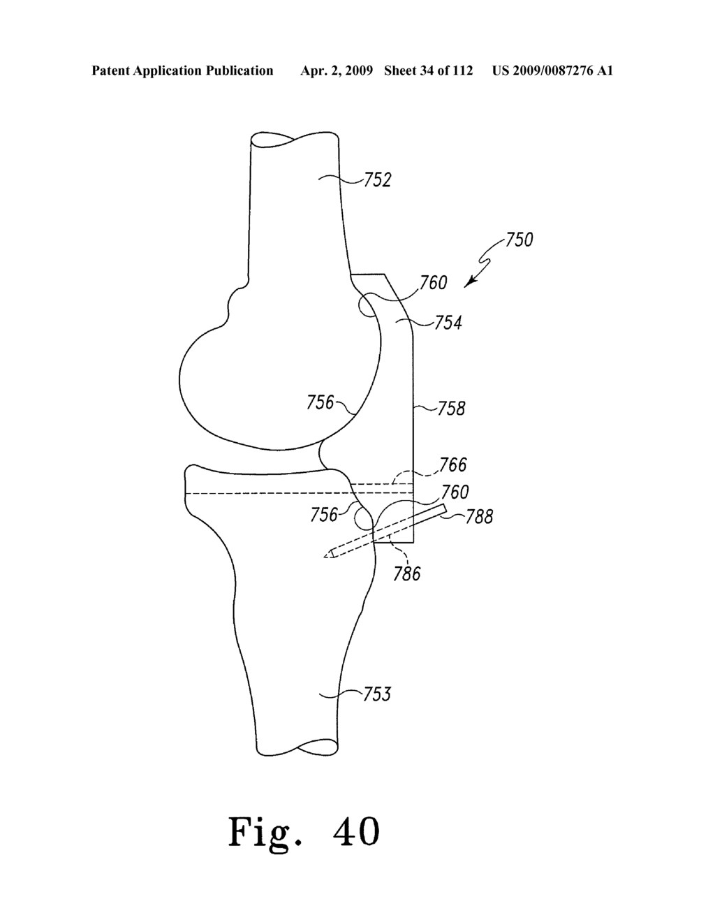 Apparatus and Method for Fabricating a Customized Patient-Specific Orthopaedic Instrument - diagram, schematic, and image 35