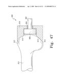 Apparatus and Method for Fabricating a Customized Patient-Specific Orthopaedic Instrument diagram and image