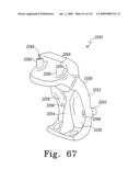 Apparatus and Method for Fabricating a Customized Patient-Specific Orthopaedic Instrument diagram and image